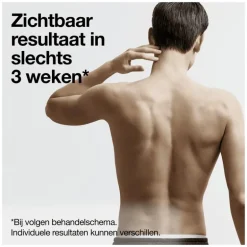 Braun IPL Silk-expert Pro 5 PL5145