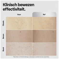 Braun IPL Silk-expert Pro 5 PL5145