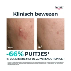 Eucerin DERMOPURE CLINICAL Triple Action Fluid Serum Gevoelige Huid 40 ML