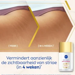NIVEA Luminous630 Anti-Striae Lichaamsolie-serum 100 ML