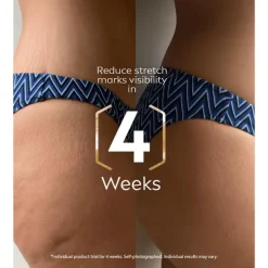 NIVEA Luminous630 Anti-Striae Lichaamsolie-serum 100 ML