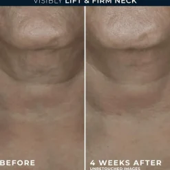 RoC Derm Correxion Contour Cream 50 ML