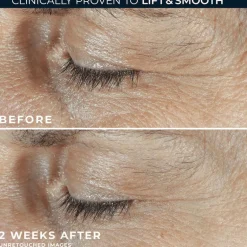 RoC Derm Correxion Dual Eye 20 ML