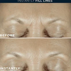 RoC Derm Correxion Fill + Treat Serum 15 ML