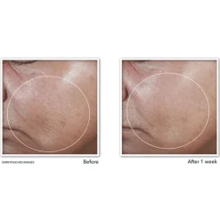 RoC Derm Correxion Firming Serum Stick