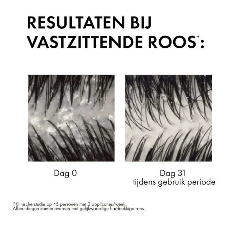 Vichy Dercos Anti-Roos Shampoo 200 ML