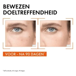 Vichy Liftactiv Vitamin C Serum 20 ML